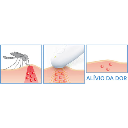 Curador Picadas Beurer BR10 | Calor, Ultra compacto, Pilhas